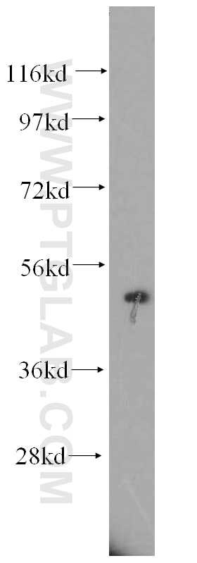Western Blot (WB) analysis of Jurkat cells using CYP17A1 Polyclonal antibody (14447-1-AP)