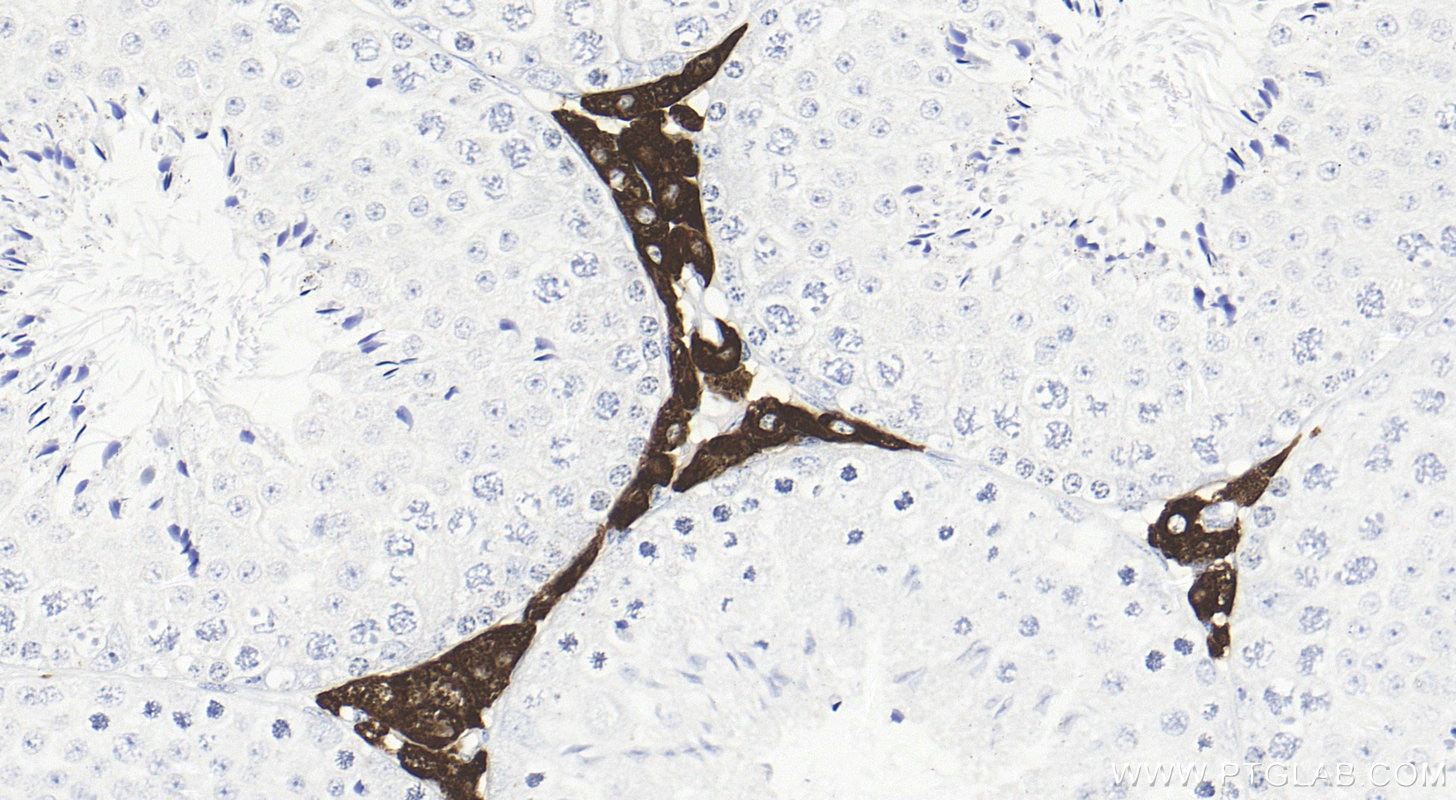 Immunohistochemistry (IHC) staining of mouse testis tissue using CYP17A1 Recombinant antibody (85690-5-RR)
