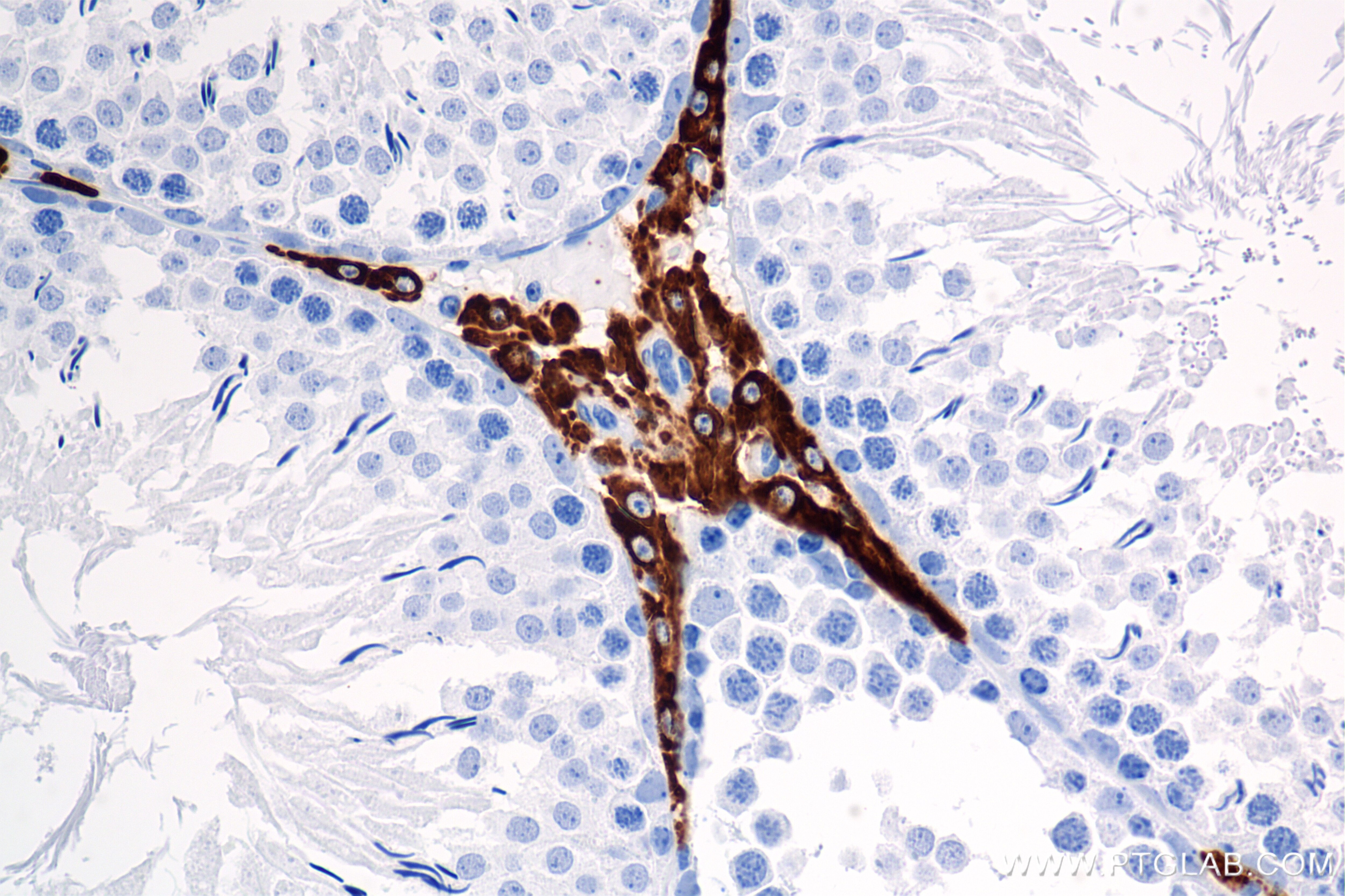 Immunohistochemistry (IHC) staining of rat testis tissue using CYP17A1 Recombinant monoclonal antibody (85690-5-RR)