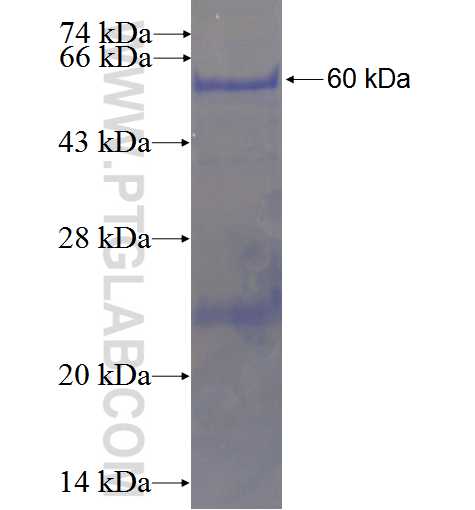 CYP17A1 fusion protein Ag5899 SDS-PAGE
