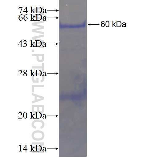 CYP17A1 fusion protein Ag5899 SDS-PAGE