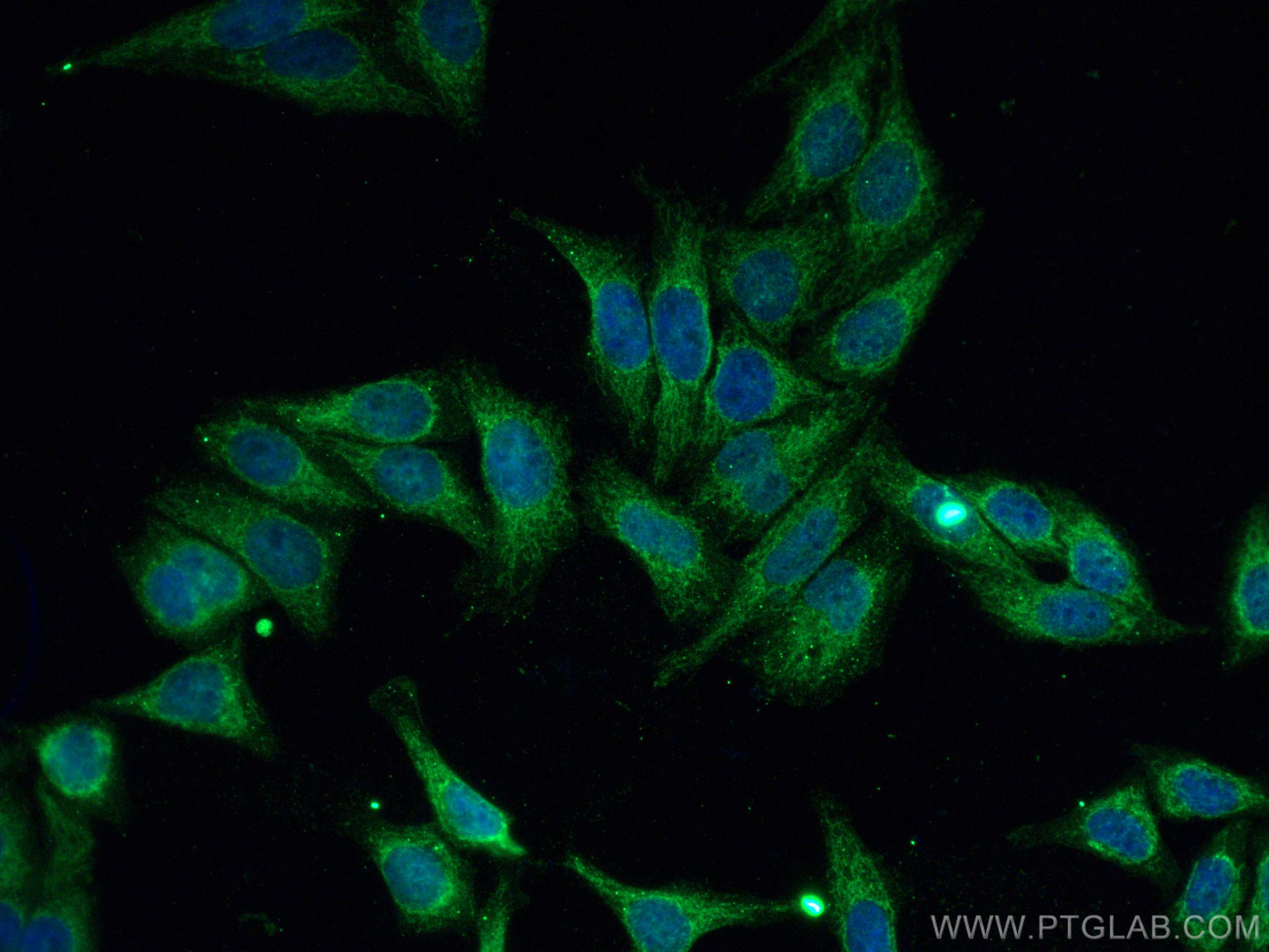 Immunofluorescence (IF) / fluorescent staining of HepG2 cells using CYP19A1 Polyclonal antibody (16554-1-AP)