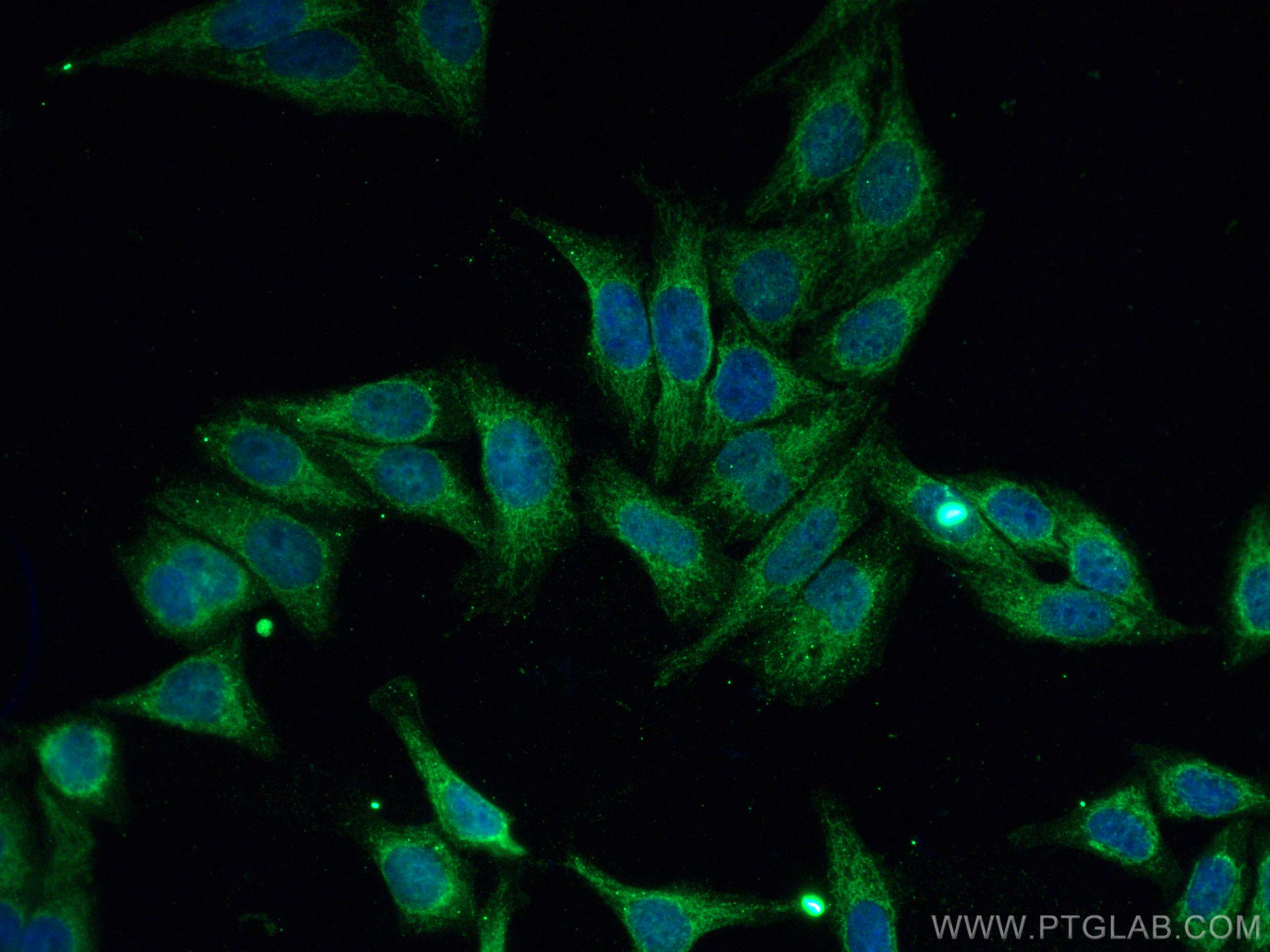 IF Staining of HepG2 using 16554-1-AP