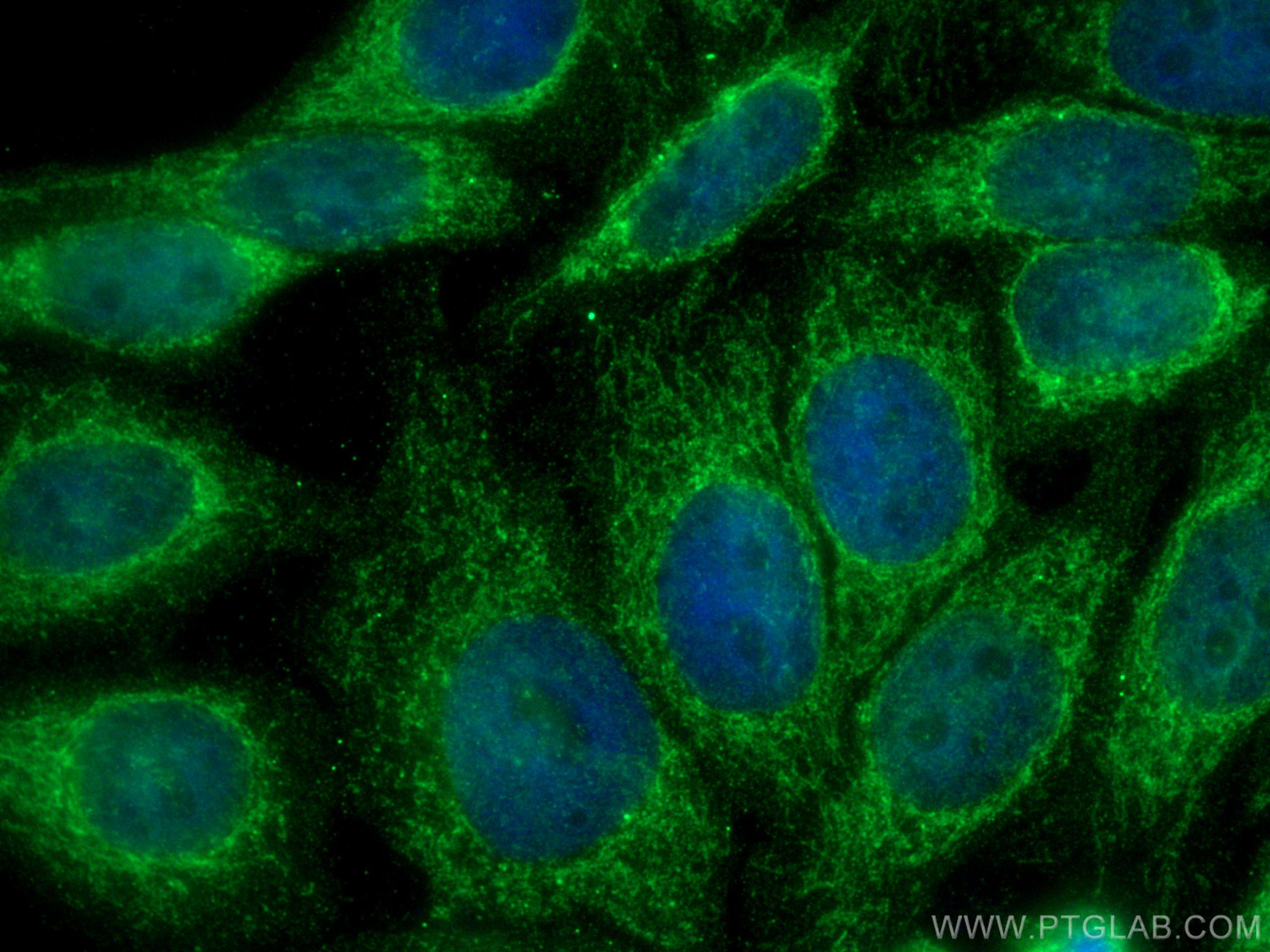 Immunofluorescence (IF) / fluorescent staining of HepG2 cells using CYP19A1 Polyclonal antibody (16554-1-AP)