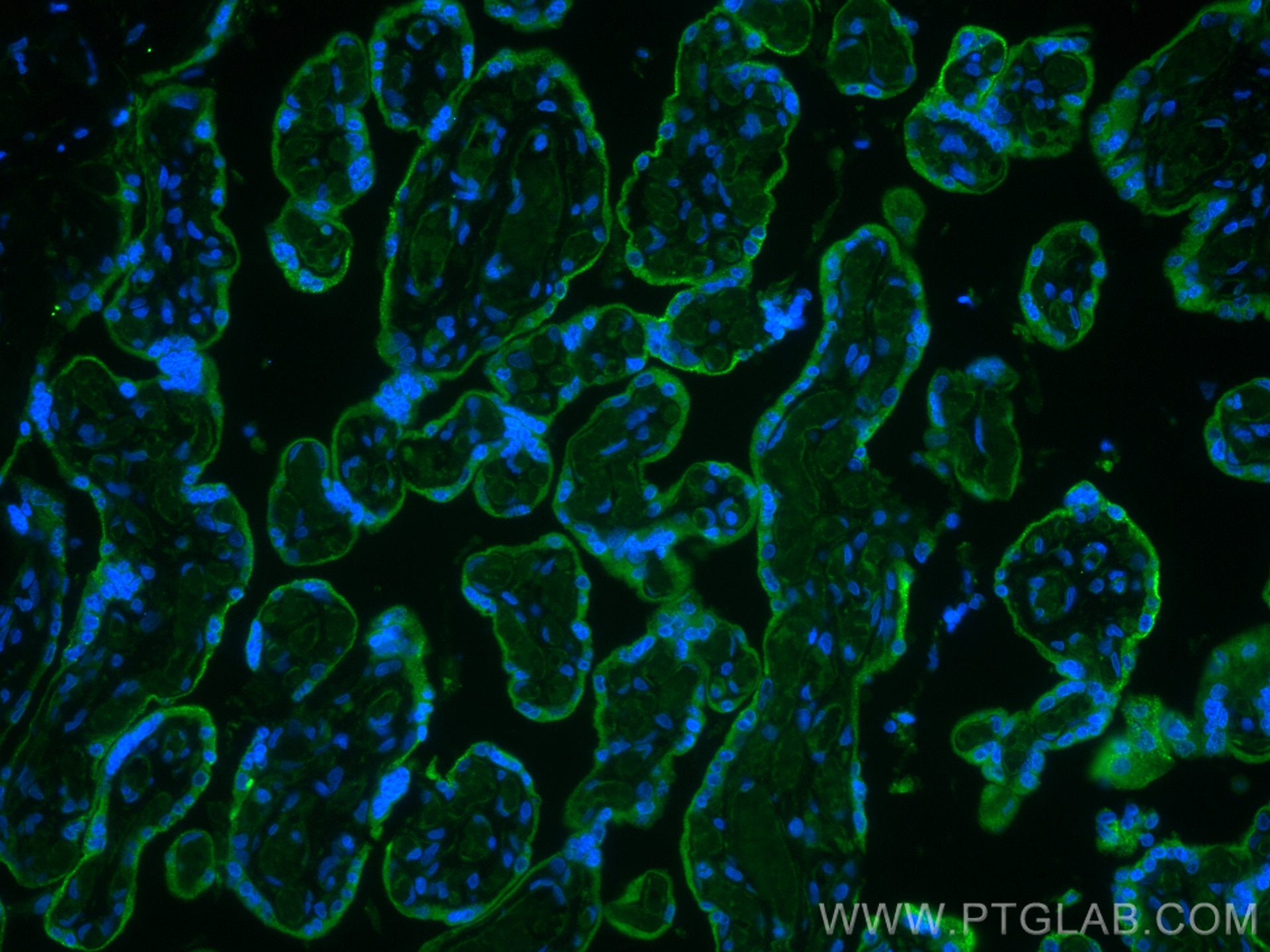 Immunofluorescence (IF) / fluorescent staining of human placenta tissue using CYP19A1 Polyclonal antibody (16554-1-AP)