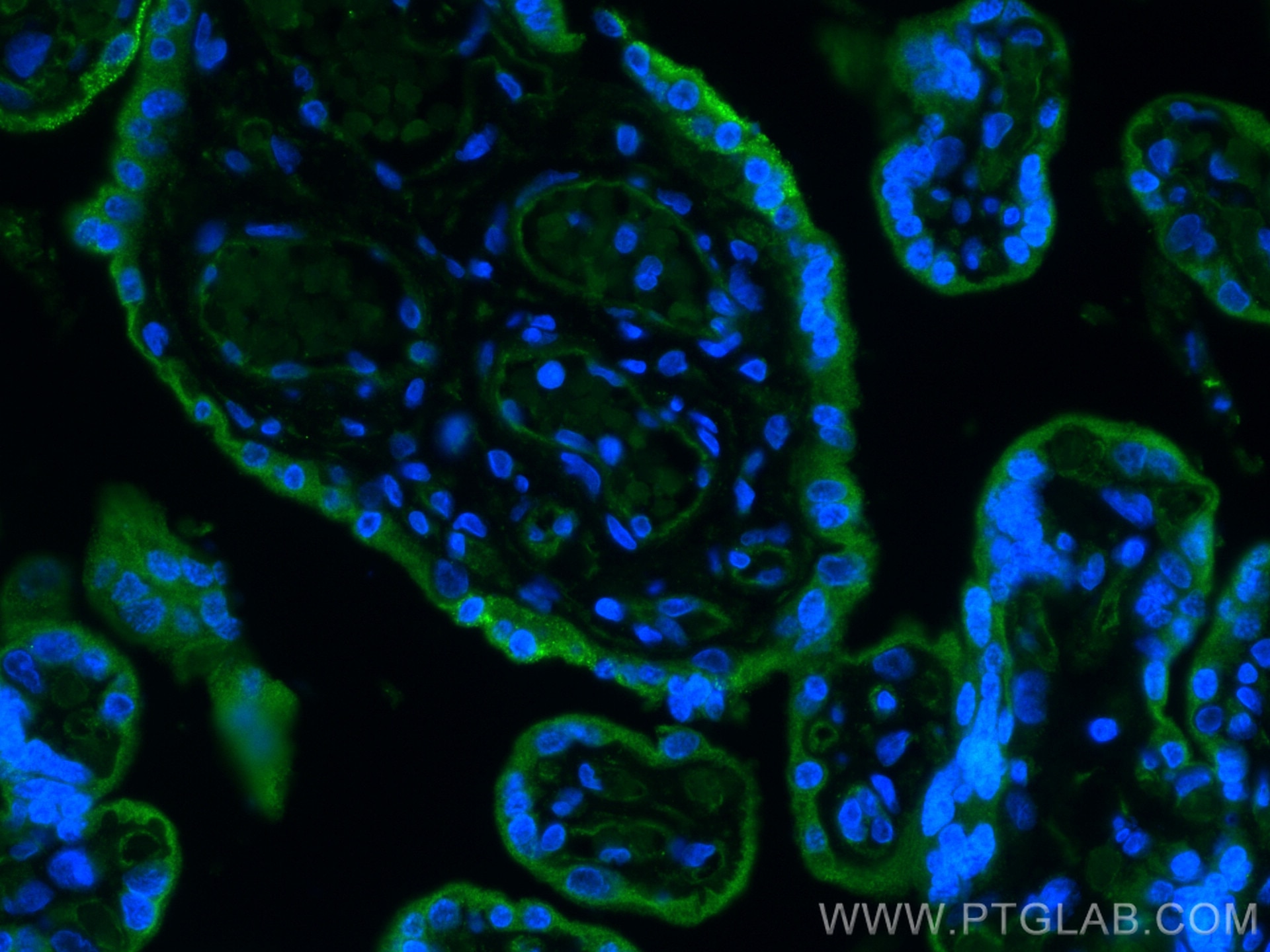 Immunofluorescence (IF) / fluorescent staining of human placenta tissue using CYP19A1 Polyclonal antibody (16554-1-AP)