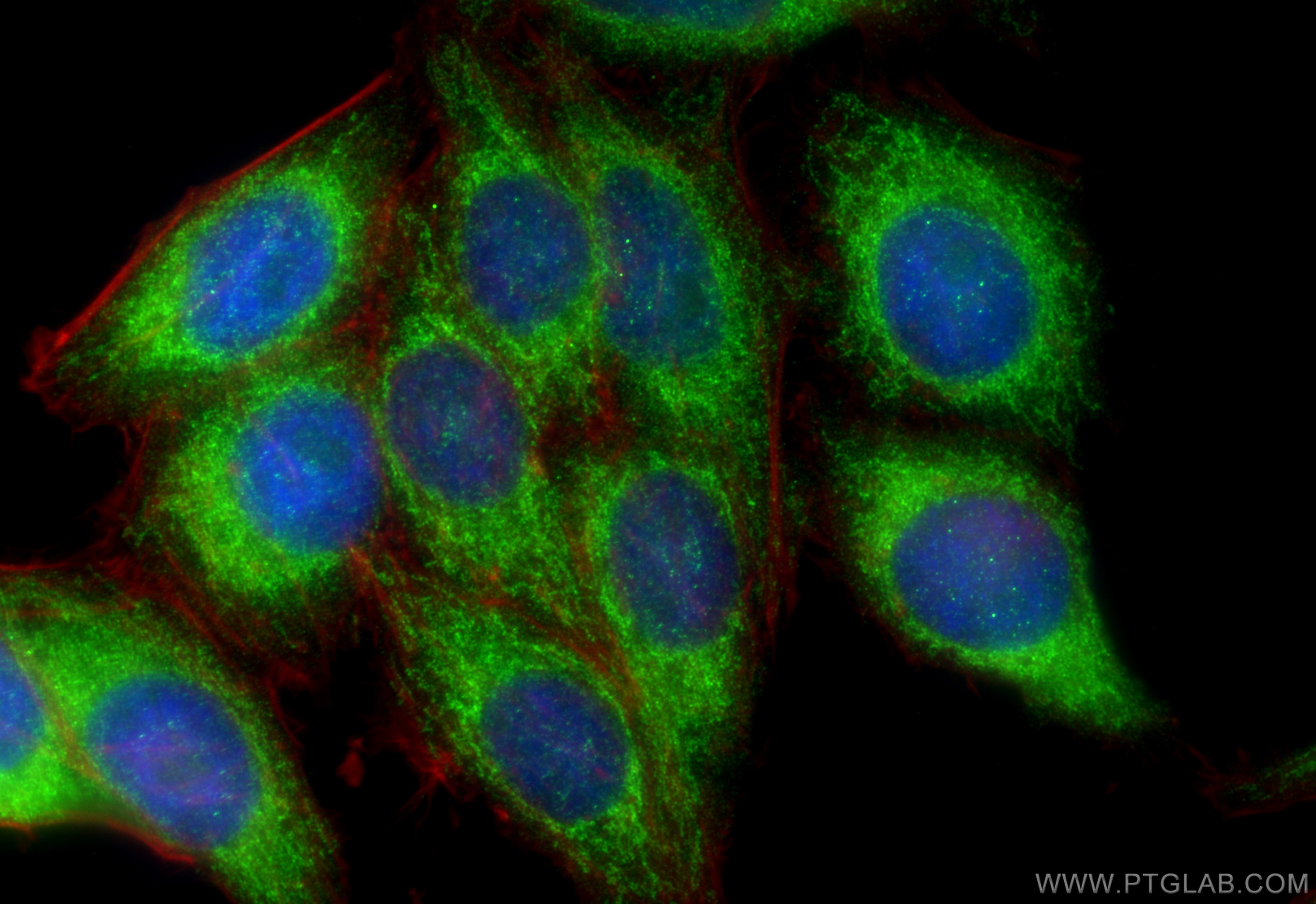 Immunofluorescence (IF) / fluorescent staining of HepG2 cells using CYP19A1 Polyclonal antibody (16554-1-AP)