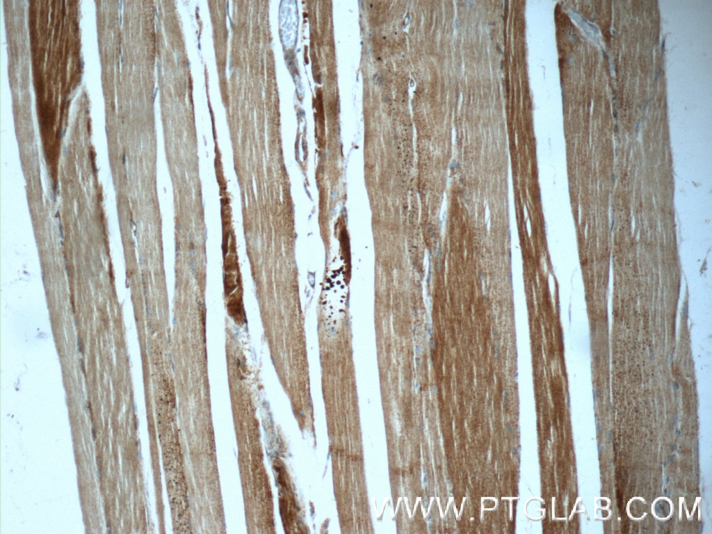 Immunohistochemistry (IHC) staining of human skeletal muscle tissue using CYP19A1 Polyclonal antibody (16554-1-AP)