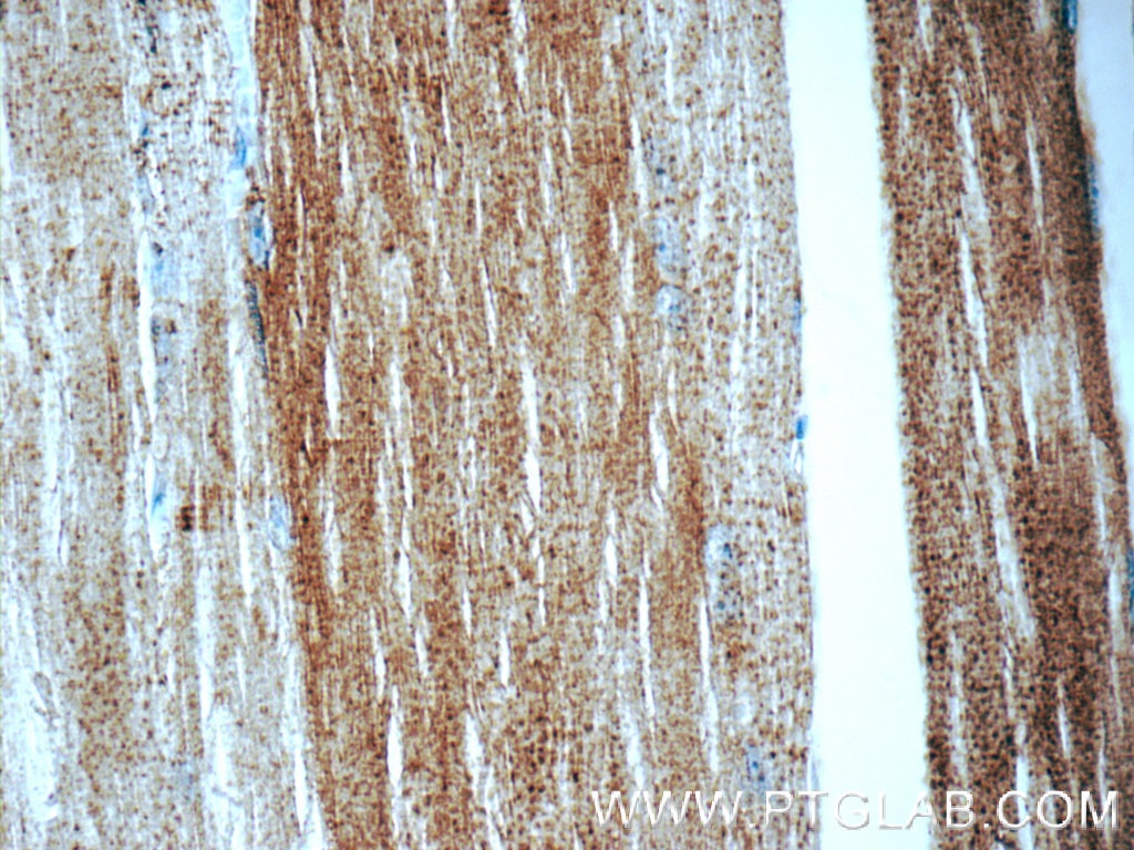 Immunohistochemistry (IHC) staining of human skeletal muscle tissue using CYP19A1 Polyclonal antibody (16554-1-AP)