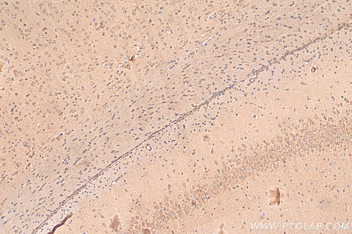 Immunohistochemistry (IHC) staining of rat brain tissue using CYP19A1 Polyclonal antibody (16554-1-AP)