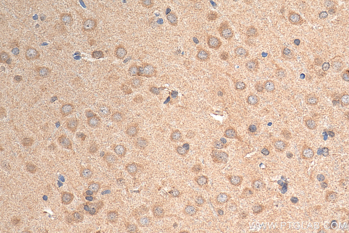 Immunohistochemistry (IHC) staining of rat brain tissue using CYP19A1 Polyclonal antibody (16554-1-AP)