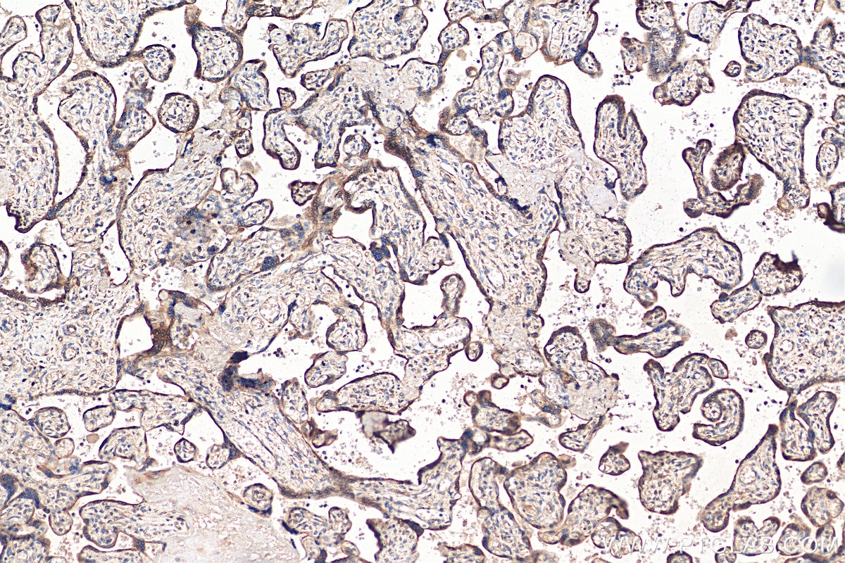 Immunohistochemistry (IHC) staining of human placenta tissue using CYP19A1 Polyclonal antibody (16554-1-AP)