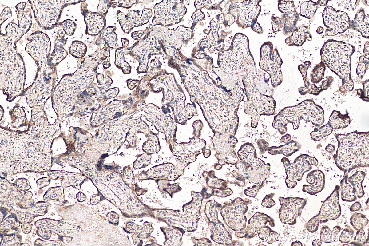 IHC staining of human placenta using 16554-1-AP