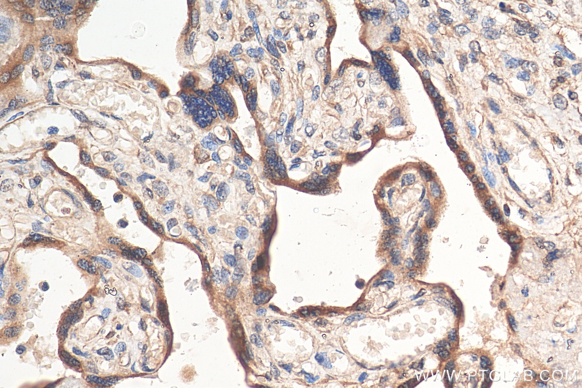 Immunohistochemistry (IHC) staining of human placenta tissue using CYP19A1 Polyclonal antibody (16554-1-AP)