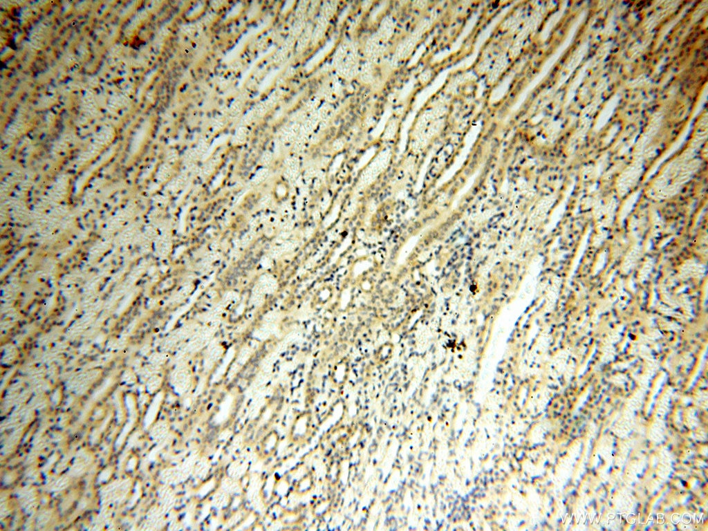 Immunohistochemistry (IHC) staining of human kidney tissue using CYP19A1 Polyclonal antibody (16554-1-AP)