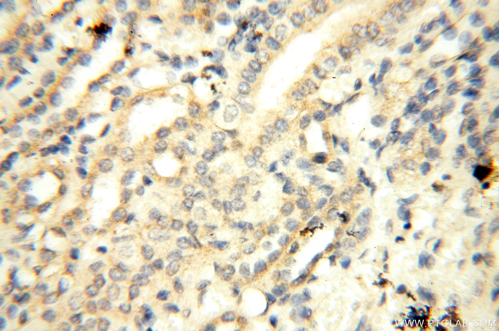 Immunohistochemistry (IHC) staining of human kidney tissue using CYP19A1 Polyclonal antibody (16554-1-AP)
