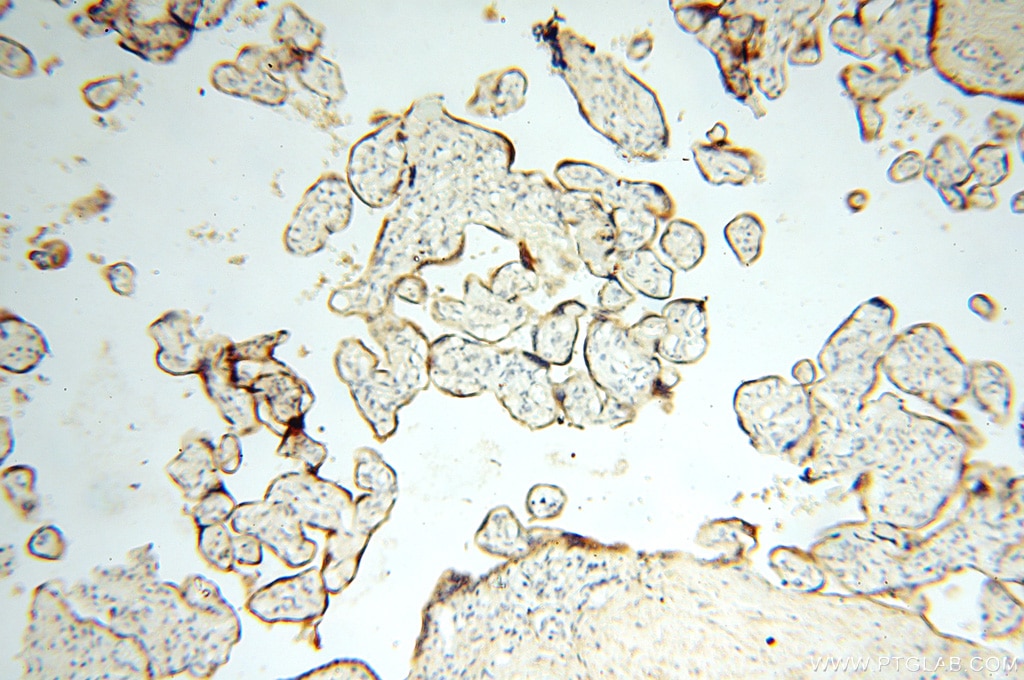 IHC staining of human placenta using 16554-1-AP
