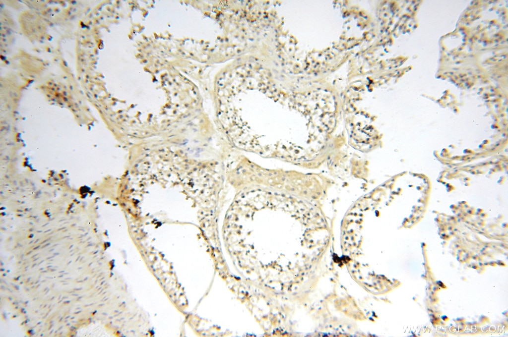 Immunohistochemistry (IHC) staining of human testis tissue using CYP19A1 Polyclonal antibody (16554-1-AP)