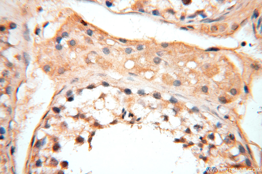 Immunohistochemistry (IHC) staining of human testis tissue using CYP19A1 Polyclonal antibody (16554-1-AP)