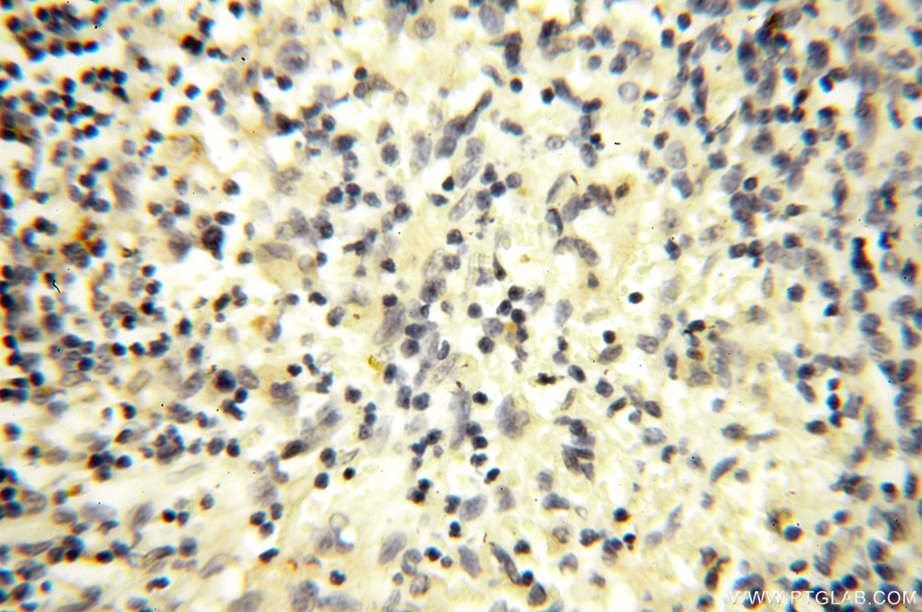Immunohistochemistry (IHC) staining of human spleen tissue using CYP19A1 Polyclonal antibody (16554-1-AP)