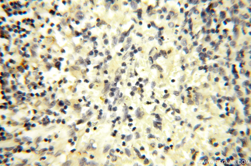 IHC staining of human spleen using 16554-1-AP