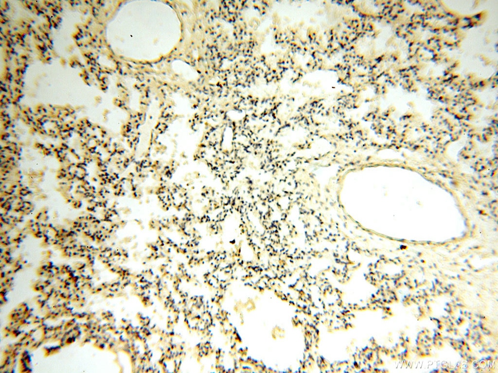 Immunohistochemistry (IHC) staining of human lung tissue using CYP19A1 Polyclonal antibody (16554-1-AP)