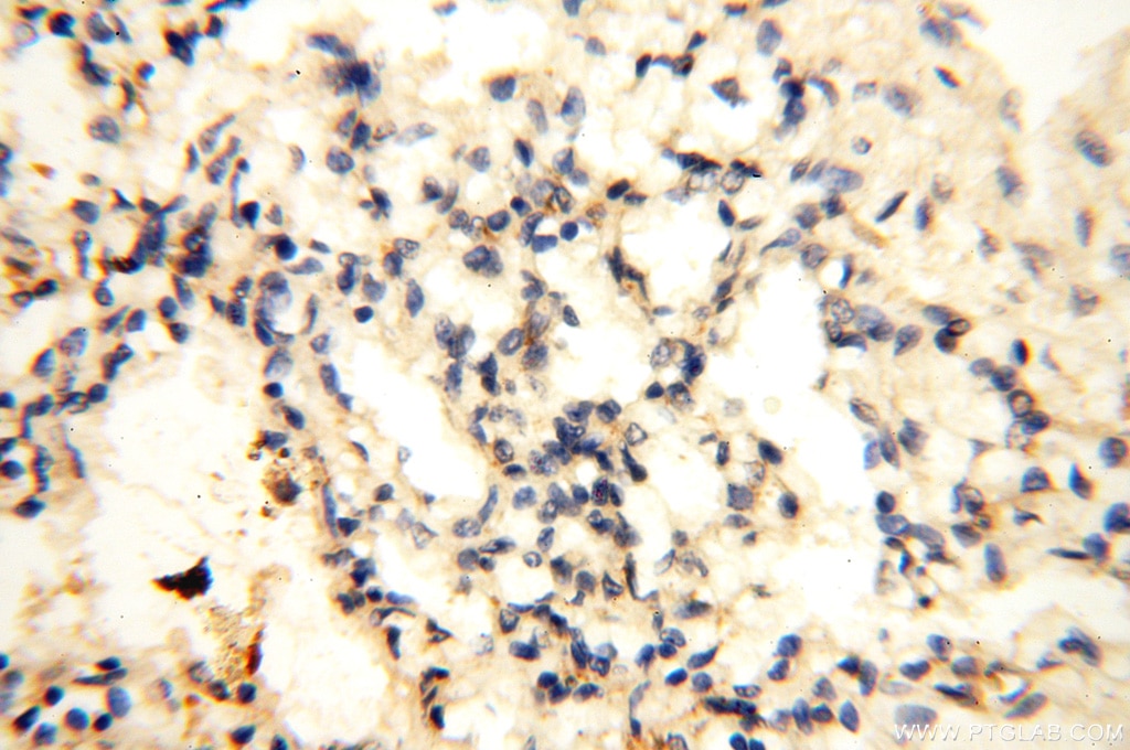 Immunohistochemistry (IHC) staining of human lung tissue using CYP19A1 Polyclonal antibody (16554-1-AP)
