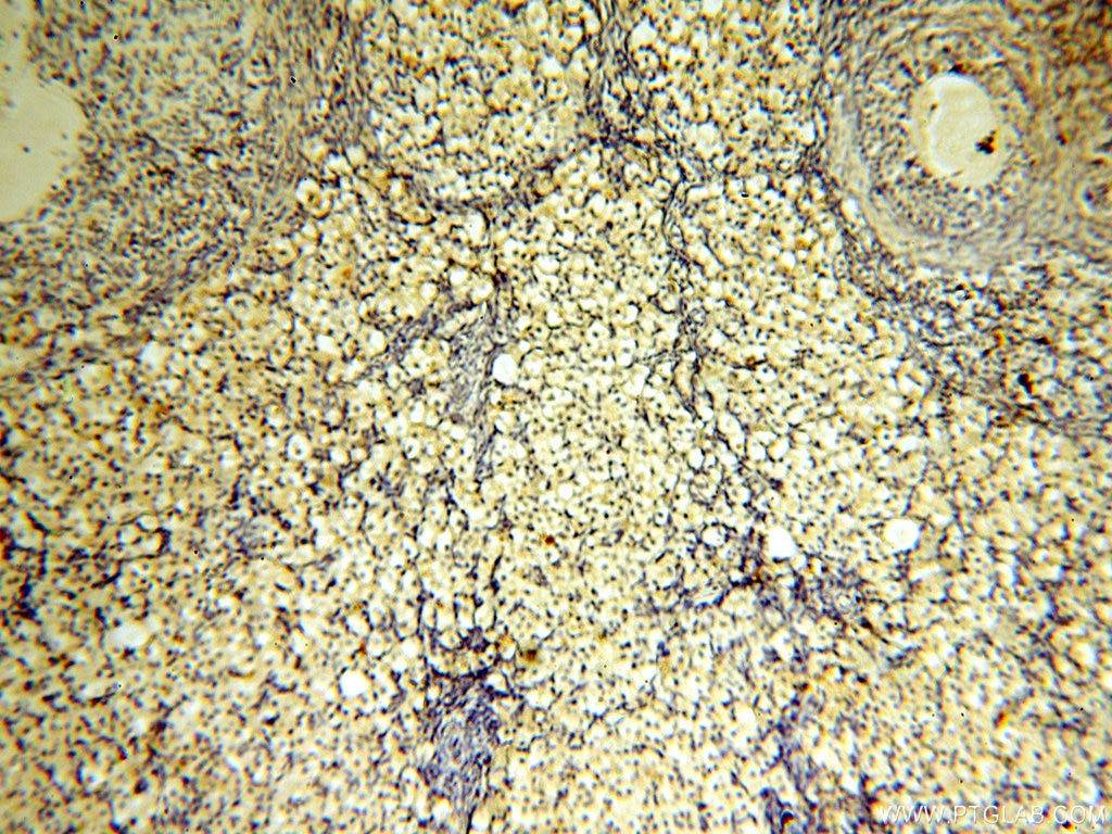 Immunohistochemistry (IHC) staining of human ovary tissue using CYP19A1 Polyclonal antibody (16554-1-AP)