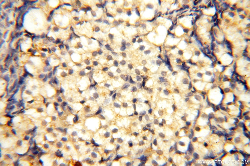 Immunohistochemistry (IHC) staining of human ovary tissue using CYP19A1 Polyclonal antibody (16554-1-AP)