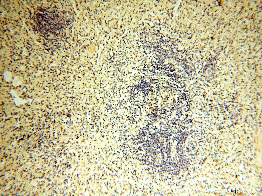 Immunohistochemistry (IHC) staining of human spleen tissue using CYP19A1 Polyclonal antibody (16554-1-AP)