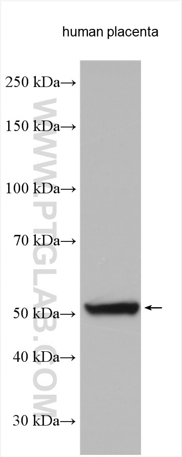 Western Blot (WB) analysis of human placenta tissue using CYP19A1 Polyclonal antibody (16554-1-AP)