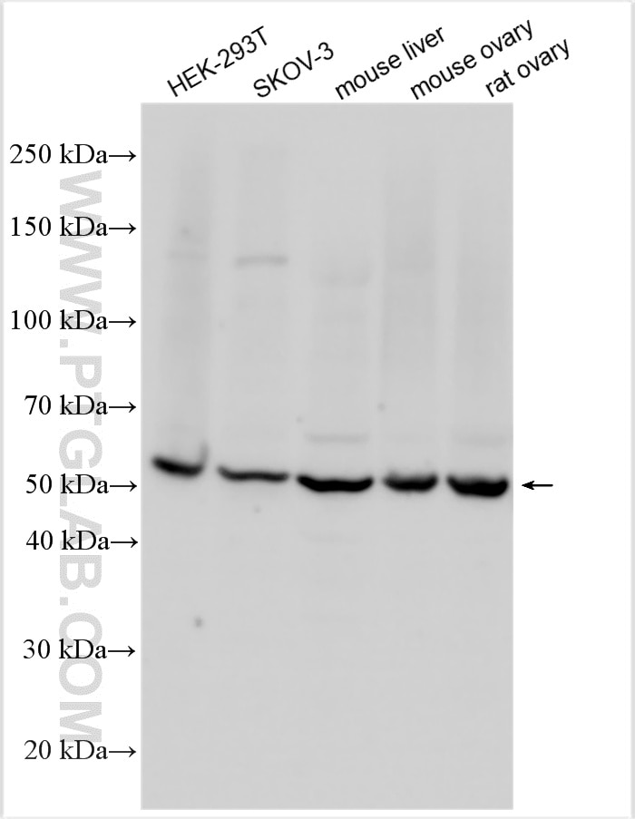Western Blot (WB) analysis of various lysates using CYP19A1 Polyclonal antibody (16554-1-AP)