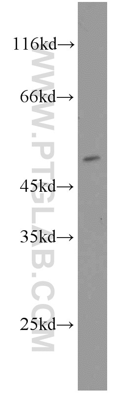Western Blot (WB) analysis of A2780 cells using CYP19A1 Polyclonal antibody (16554-1-AP)