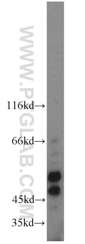 Western Blot (WB) analysis of mouse ovary tissue using CYP19A1 Polyclonal antibody (16554-1-AP)