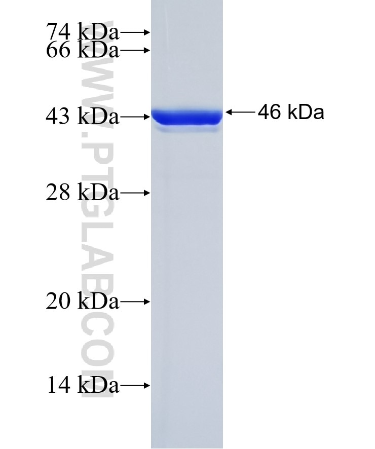 CYP19A1 fusion protein Ag29004 SDS-PAGE