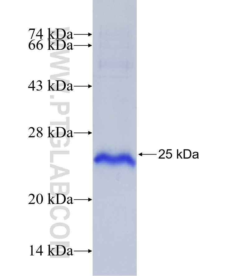 CYP19A1 fusion protein Ag29020 SDS-PAGE