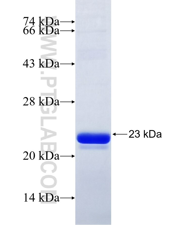 CYP19A1 fusion protein Ag9896 SDS-PAGE