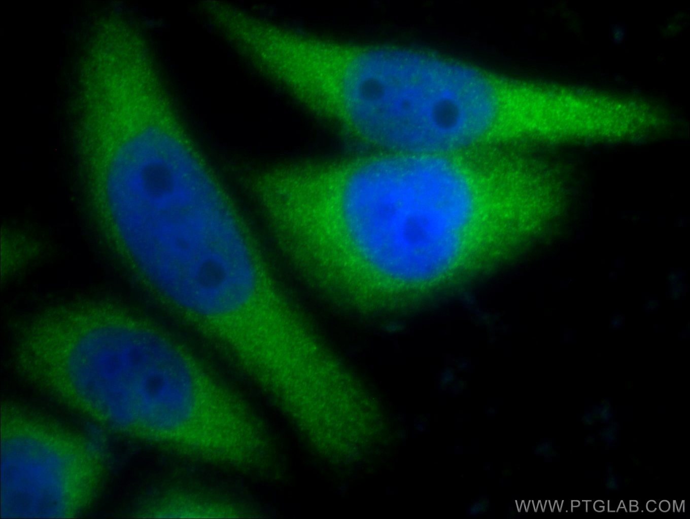 Immunofluorescence (IF) / fluorescent staining of HeLa cells using CYP1A1 Polyclonal antibody (13241-1-AP)