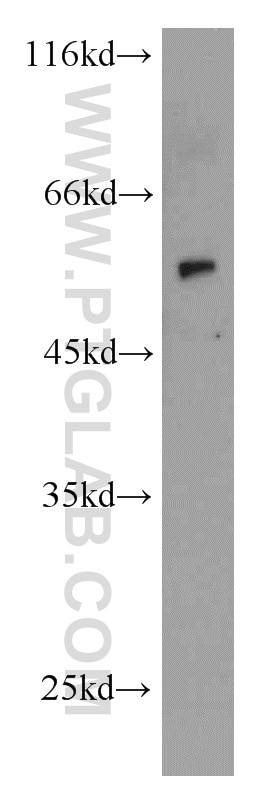 Western Blot (WB) analysis of HeLa cells using CYP1A1 Polyclonal antibody (13241-1-AP)