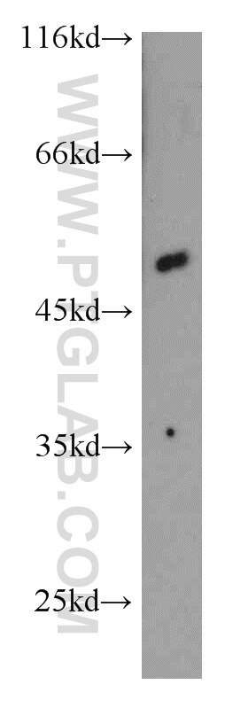 WB analysis of K-562 using 13241-1-AP