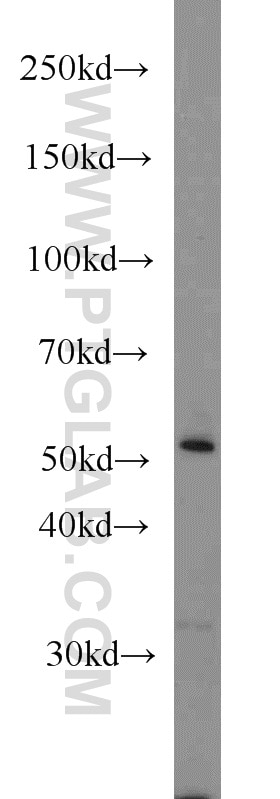 WB analysis of mouse lung using 13241-1-AP