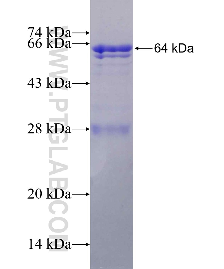 CYP1A1 fusion protein Ag3990 SDS-PAGE
