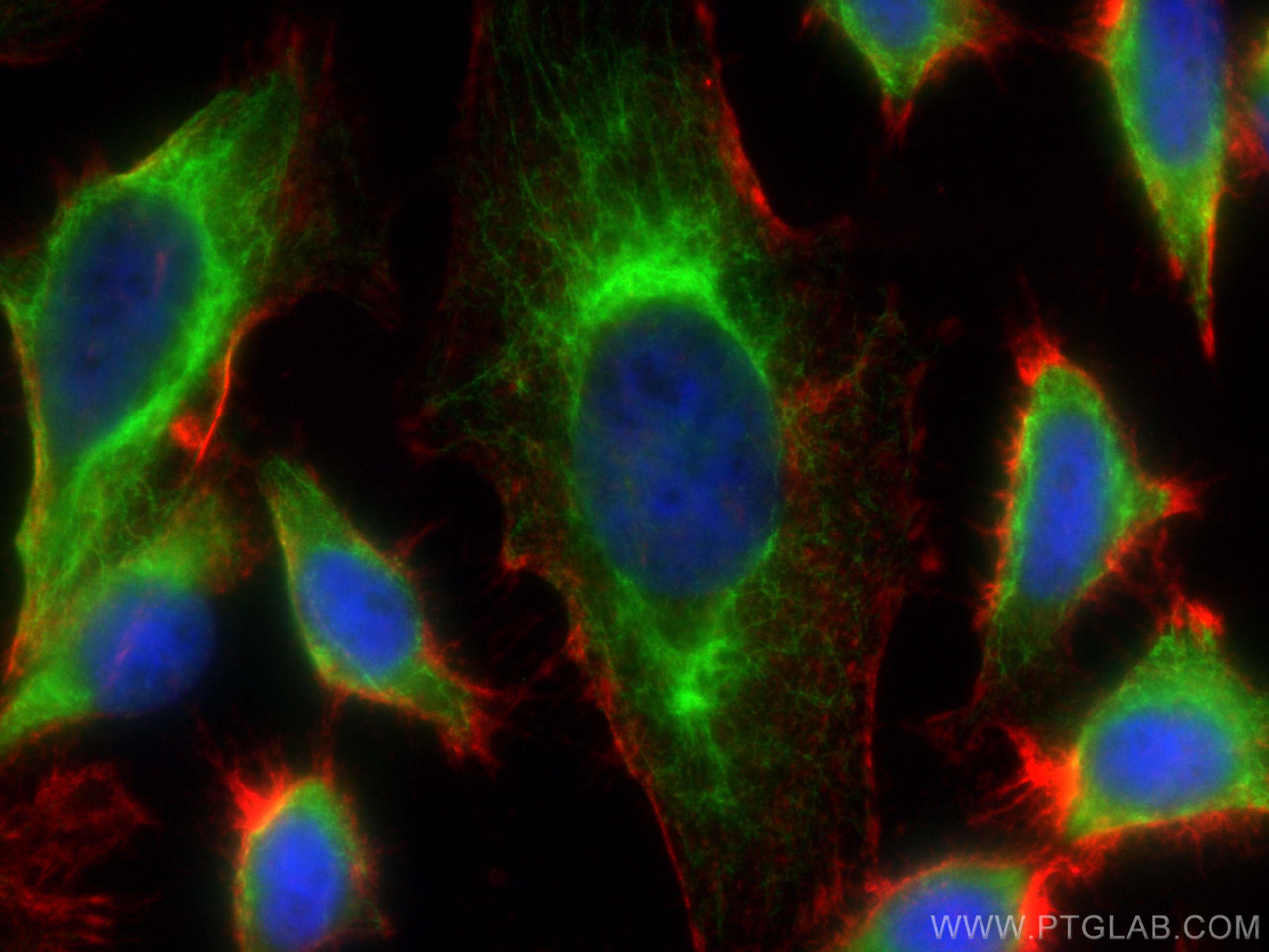 Immunofluorescence (IF) / fluorescent staining of HeLa cells using CYP1A2-Specific Polyclonal antibody (19936-1-AP)