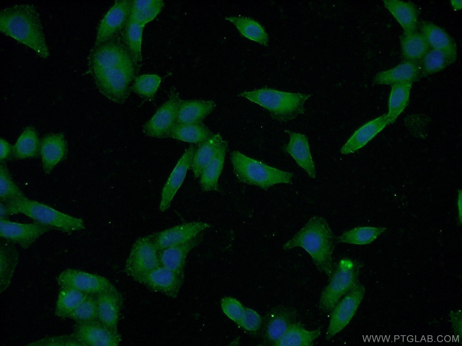 Immunofluorescence (IF) / fluorescent staining of HeLa cells using CYP1A2-Specific Polyclonal antibody (19936-1-AP)