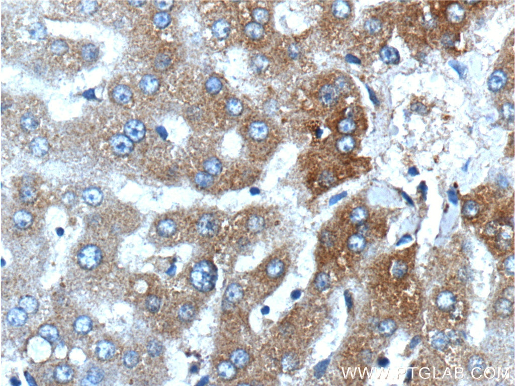 Immunohistochemistry (IHC) staining of human liver tissue using CYP1A2-Specific Polyclonal antibody (19936-1-AP)
