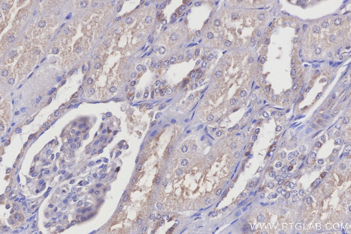 Immunohistochemistry (IHC) staining of human kidney tissue using CYP1A2-Specific Polyclonal antibody (19936-1-AP)