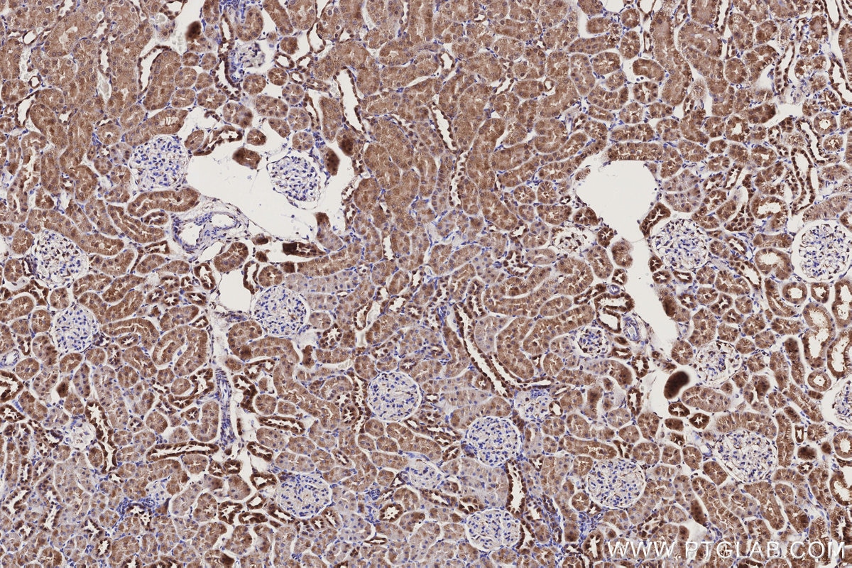 Immunohistochemistry (IHC) staining of rat kidney tissue using CYP1A2-Specific Polyclonal antibody (19936-1-AP)