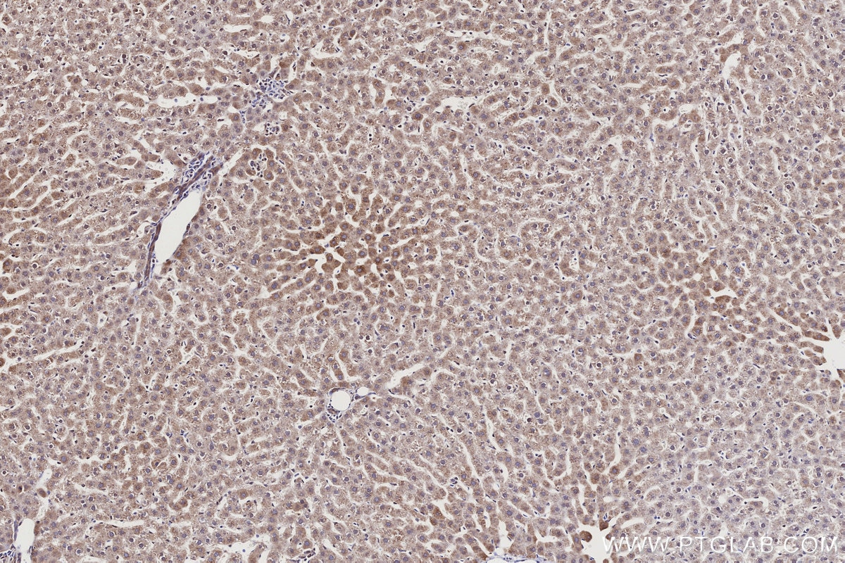 Immunohistochemistry (IHC) staining of rat liver tissue using CYP1A2-Specific Polyclonal antibody (19936-1-AP)