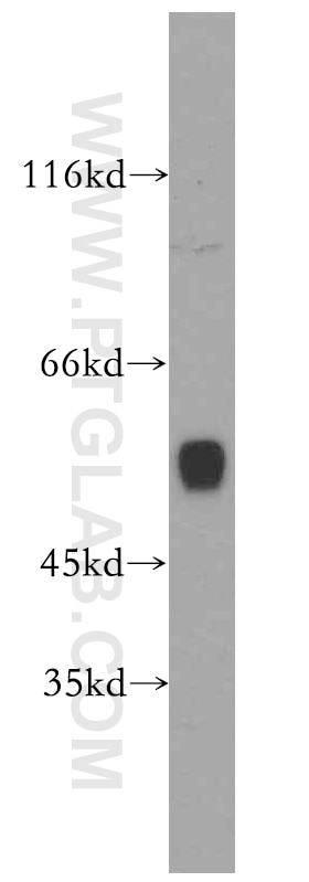 Western Blot (WB) analysis of mouse liver tissue using CYP1A2-Specific Polyclonal antibody (19936-1-AP)