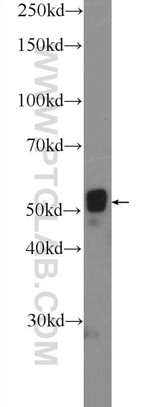 Western Blot (WB) analysis of MCF-7 cells using CYP1B1 Polyclonal antibody (18505-1-AP)